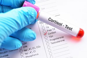 blood-test-for-cortisol